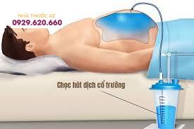 Chọc hút dịch xoang bụng