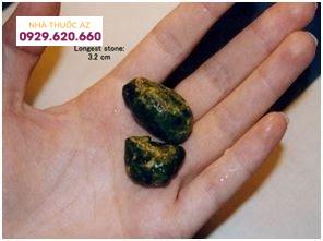 Sắc tố sỏi mật