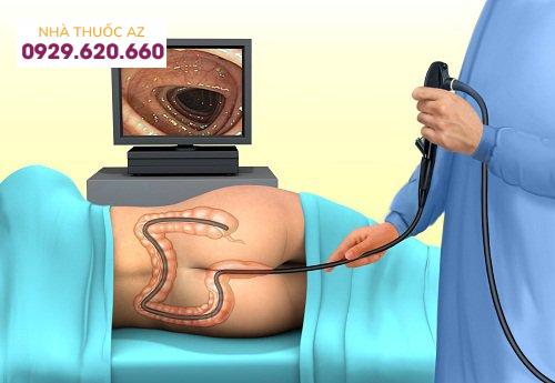 nội soi đại tràng