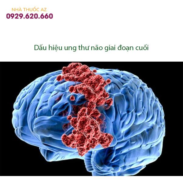 Dấu-hiệu-ung-thư-não-giai-đoạn-cuối