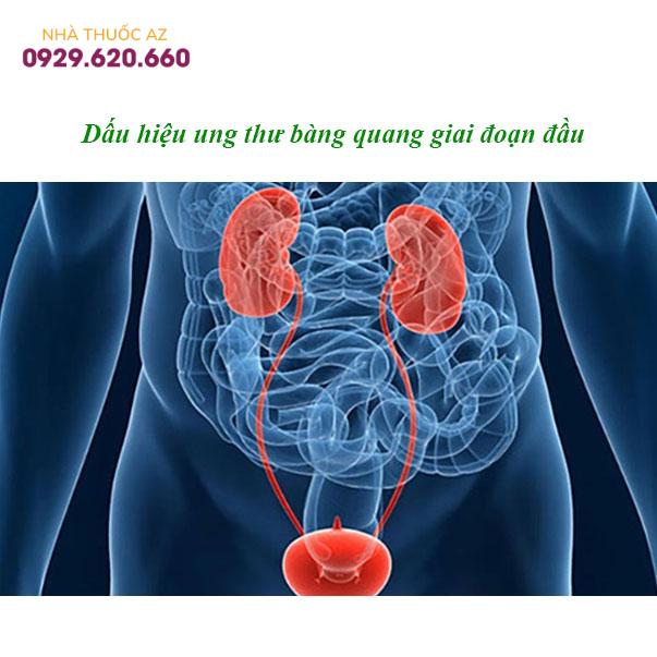 Dấu-hiệu-ung-thư-bàng-quang-giai-đoạn-đầu