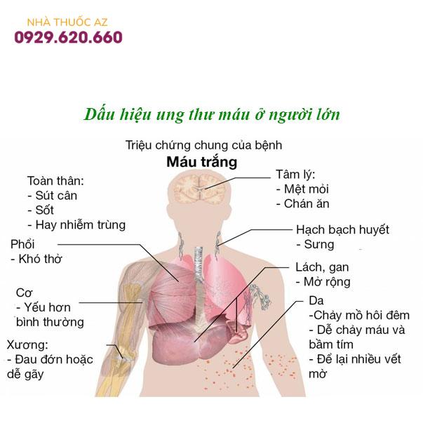 Dấu-hiệu-ung-thư-máu-ở-người-lớn