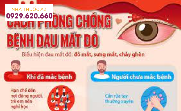 Cách ngừa đau mắt đỏ