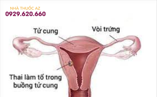 Thai bao nhiêu tuần thì vào tử cung