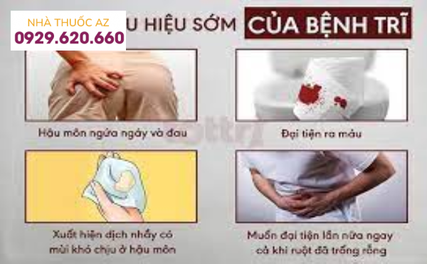 Triệu chứng của bệnh trĩ