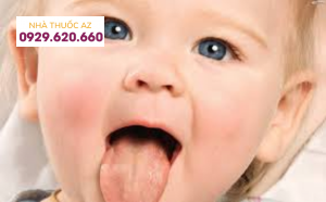 Dấu hiệu ung thư lưỡi ở trẻ em