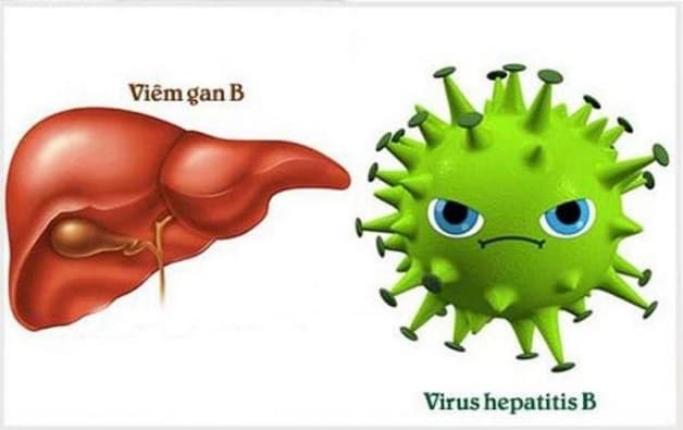 Viêm gan B mạn tính